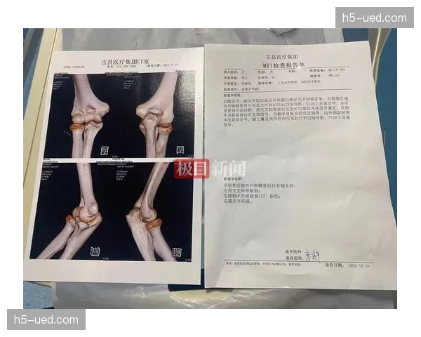 检查报告出炉，法国女手主力组织核心膝伤无大碍，可赶及奥运。